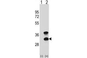 Western blot analysis of CD79b antibody and 293 cell lysate (2 ug/lane) either nontransfected (Lane 1) or transiently transfected (2) with the CD79B gene. (CD79b Antikörper  (AA 93-121))