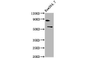 Western Blotting (WB) image for anti-SWI/SNF Related, Matrix Associated, Actin Dependent Regulator of Chromatin, Subfamily D, Member 2 (SMARCD2) (AA 1-113) antibody (ABIN7171075)