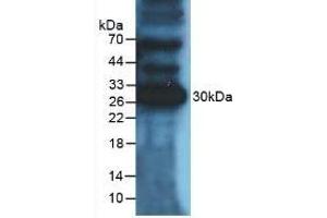 Detection of PDL1 in Mouse Heart Tissue using Polyclonal Antibody to Programmed Cell Death Protein 1 Ligand 1 (PDL1) (PD-L1 Antikörper  (AA 48-290))