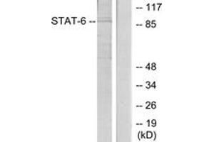 Western Blotting (WB) image for anti-Signal Transducer and Activator of Transcription 6, Interleukin-4 Induced (STAT6) (AA 612-661) antibody (ABIN2889070) (STAT6 Antikörper  (AA 612-661))