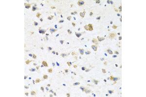 Immunohistochemistry of paraffin-embedded mouse brain using PGR antibody at dilution of 1:100 (x40 lens).