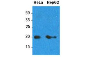 Western Blotting (WB) image for anti-ADP-Ribosylation Factor 1 (ARF1) antibody (ABIN781542) (ARF1 Antikörper)