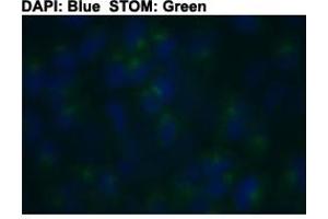 Immunofluorescent staining of HeLa cells with STOM polyclonal antibody  at 1:150 dilution. (Stomatin Antikörper  (C-Term))