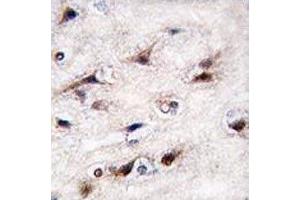 Immunohistochemistry (IHC) image for anti-Nuclear Receptor Subfamily 4, Group A, Member 2 (NR4A2) (AA 13-42) antibody (ABIN3032065)