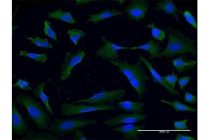 Immunofluorescence of monoclonal antibody to USP9X on HeLa cell. (USP9X Antikörper  (AA 1-90))