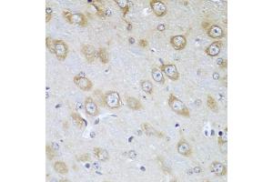 Immunohistochemistry of paraffin-embedded mouse brain using TMOD3 antibody. (TMOD3 Antikörper)