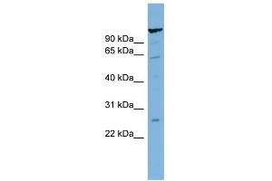 WB Suggested Anti-C6orf10 Antibody Titration:  0. (CDNA Sequence BC051142 (BC051142) (Middle Region) Antikörper)