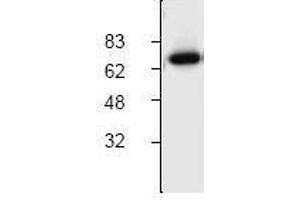Image no. 1 for anti-Cholesteryl Ester Transfer Protein (CETP) (C-Term) antibody (ABIN127095) (CETP Antikörper  (C-Term))