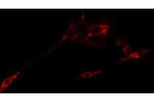 ABIN6274766 staining Hela cells by IF/ICC. (RPL10L Antikörper  (C-Term))