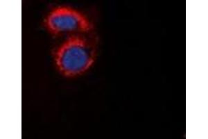 Immunofluorescent analysis of mPR alpha staining in A549 cells. (PAQR7 Antikörper  (C-Term))