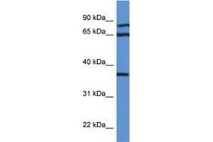 Image no. 1 for anti-Deoxyhypusine Synthase (DHPS) (AA 51-100) antibody (ABIN6746962) (DHPS Antikörper  (AA 51-100))