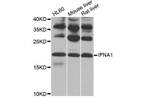 Western blot analysis of extracts of various cell lines, using IFNA1 antibody (ABIN1873146) at 1:1000 dilution.