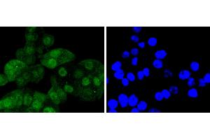 SW480 cells were stained with Cdk6 (4F7) Monoclonal Antibody  at [1:200] incubated overnight at 4C, followed by secondary antibody incubation, DAPI staining of the nuclei and detection. (CDK6 Antikörper)