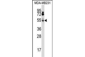 HTRA2 Antibody (N-term) (ABIN657628 and ABIN2846624) western blot analysis in MDA-M cell line lysates (35 μg/lane). (HTRA2 Antikörper  (N-Term))
