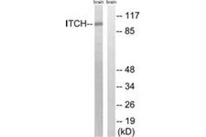 Western blot analysis of extracts from mouse brain cells, using ITCH (Ab-420) Antibody. (ITCH Antikörper  (AA 386-435))