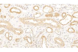 Detection of CDKN1A in Human Kidney Tissue using Polyclonal Antibody to Cyclin Dependent Kinase Inhibitor 1A (CDKN1A) (p21 Antikörper  (AA 1-164))