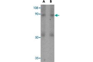 Western blot analysis of CD248 in human colon tissue lysate with CD248 polyclonal antibody  at (A) 0. (CD248 Antikörper  (N-Term))