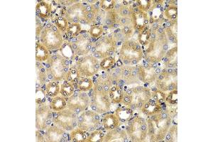 Immunohistochemistry of paraffin-embedded mouse kidney using SMAD9 antibody (ABIN5975592) at dilution of 1/100 (40x lens). (SMAD9 Antikörper)