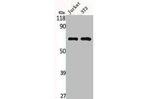 Western Blot analysis of Jurkat NIH-3T3 cells using MMP-2 Polyclonal Antibody (MMP2 Antikörper  (C-Term))
