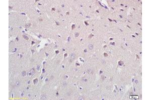 Formalin-fixed and paraffin embedded rat brain labeled with Anti CROT Polyclonal Antibody, Unconjugated (ABIN708896) at 1:200 followed by conjugation to the secondary antibody and DAB staining (CROT Antikörper  (AA 41-140))