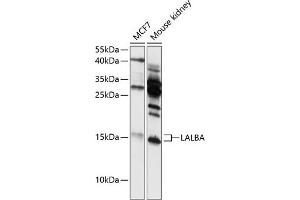 Western blot analysis of extracts of various cell lines, using LALBA antibody (ABIN6130518, ABIN6143065, ABIN6143066 and ABIN6216420) at 1:3000 dilution. (LALBA Antikörper  (AA 20-142))
