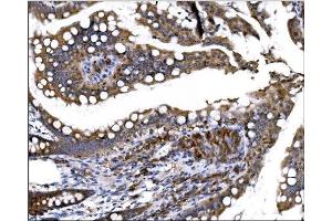 IHC analysis of Prolyl Endopeptidase/PREP using anti-Prolyl Endopeptidase/PREP antibody (ABIN7599118). (PREP Antikörper  (AA 1-227))