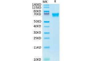 Biotinylated Human AXL on Tris-Bis PAGE under reduced condition. (AXL Protein (His-Avi Tag,Biotin))