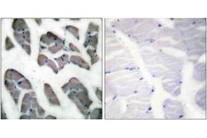 Immunohistochemistry analysis of paraffin-embedded human skeletal muscle tissue, using Actin-gamma2 Antibody. (ACTG2 Antikörper  (AA 1-50))