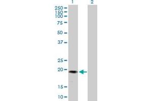 Western Blot analysis of GREM2 expression in transfected 293T cell line by GREM2 MaxPab polyclonal antibody. (GREM2 Antikörper  (AA 1-168))