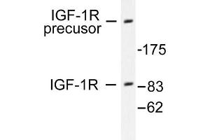 Image no. 1 for anti-Insulin-Like Growth Factor 1 Receptor (IGF1R) antibody (ABIN265475) (IGF1R Antikörper)