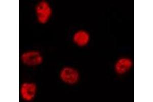 ABIN6278348 staining Hela by IF/ICC. (CHD5 Antikörper  (Internal Region))