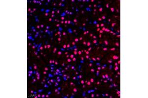 Immunofluorescence of paraffin embedded mouse kidney using ZNF106 (ABIN7076260) at dilution of 1:500 (400x lens) (ZFP106 Antikörper)