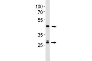 Western blot analysis of lysate from mouse liver tissue lysate using Shh antibody. (Sonic Hedgehog Antikörper  (AA 395-450))