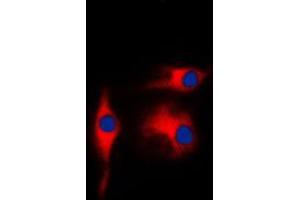 Immunofluorescent analysis of Gamma-enolase staining in K562 cells. (ENO2/NSE Antikörper  (C-Term))