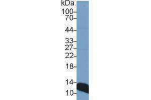 Western Blot; Sample: Rat Liver lysate; Primary Ab: 1µg/ml Rabbit Anti-Rat b2M Antibody Second Ab: 0.