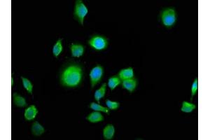 Immunofluorescence staining of A549 cells with ABIN7144052 at 1:100, counter-stained with DAPI. (ALS2CR12 Antikörper  (AA 26-76))