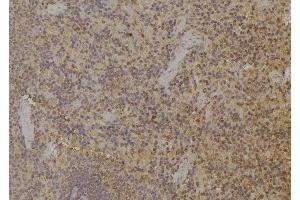 ABIN6259451 and ABIN6274942 at 1/100 staining Rat spleen tissue by IHC-P. (ARPP21 Antikörper  (Internal Region))