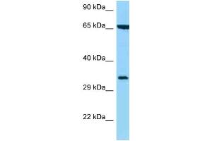 WB Suggested Anti-HLA-C Antibody Titration: 1. (HLA-C Antikörper  (C-Term))