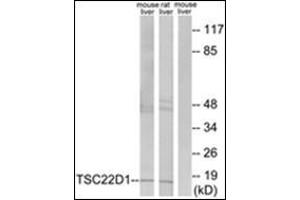Western blot analysis of extracts from mouse liver/rat liver cells, using TSC22D1 Antibody . (TSC22D1 Antikörper  (N-Term))
