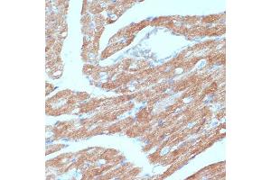 Immunohistochemistry of paraffin-embedded mouse heart using  antibody (ABIN6129863, ABIN6136456, ABIN6136457 and ABIN6215371) at dilution of 1:100 (40x lens). (Acsl3 Antikörper  (AA 42-300))