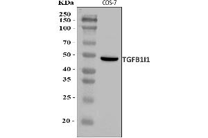 Western blot analysis of HIC5/TGFB1I1 using anti-HIC5/TGFB1I1 antibody (ABIN7600987).