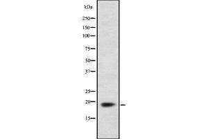 Western blot analysis of FDX1 using HepG2 whole  lysates. (Ferredoxin1 (FDX1) (Internal Region) Antikörper)