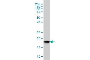 SKP1A monoclonal antibody (M01), clone 1H8 Western Blot analysis of SKP1A expression in HeLa .