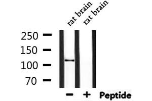 Western blot analysis of extracts from rat brain, using CEP110 Antibody. (Centriolin Antikörper)