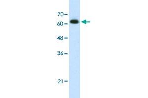 Western Blot analysis of Jurkat cell lysate with DIS3L2 polyclonal antibody  at 1. (DIS3L2 Antikörper  (N-Term))
