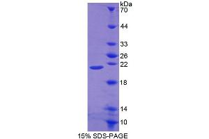 SDS-PAGE (SDS) image for Protein O-Fucosyltransferase 1 (POFUT1) (AA 243-393) protein (His tag) (ABIN6238942)