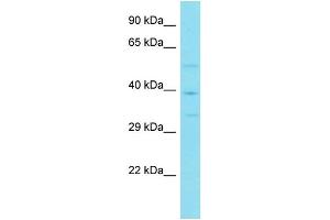 Host: Rabbit Target Name: VWC2 Sample Type: Jurkat Whole Cell lysates Antibody Dilution: 1.