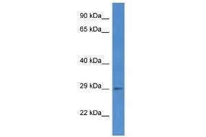 Western Blot showing SPSB2 antibody used at a concentration of 1 ug/ml against COLO205 Cell Lysate (SPSB2 Antikörper  (C-Term))
