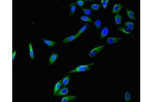 Immunofluorescent analysis of Hela cells using ABIN7148838 at dilution of 1:100 and Alexa Fluor 488-congugated AffiniPure Goat Anti-Rabbit IgG(H+L) (Cyclin C Antikörper  (AA 240-283))