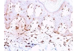 Immunohistochemistry (IHC) image for anti-Collagen, Type VII, alpha 1 (COL7A1) antibody (ABIN6939168)